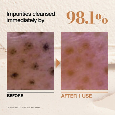 Anua - Rice Enzyme Brightening Cleansing Powder - 40g
