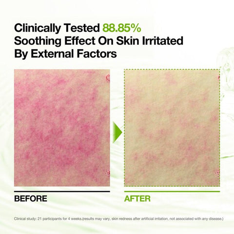 Anua - Azelaic 10 Hyaluron Redness Soothing Pad - 90Pad