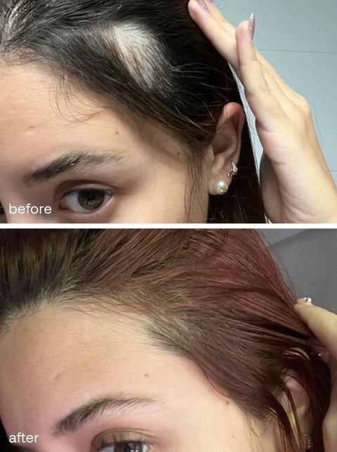 Uklash - Hair Growth Serum