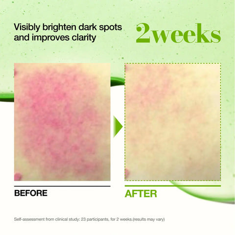 Anua - Azelaic Acid 10 Hyaluron Redness Soothing Serum