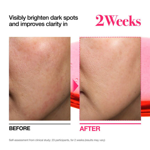 Anua - Niacinamide 10 + TXA4 Serum