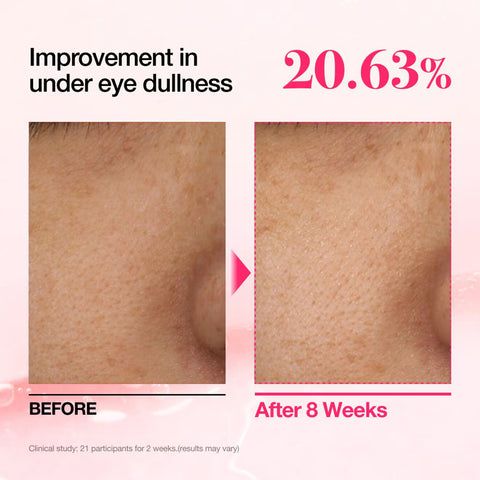 Anua - Niacinamide 5 TXA Brightening Pad - 60Pad