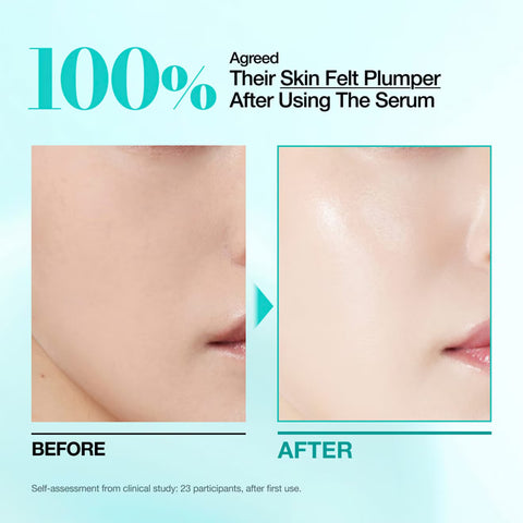 Anua - PDRN Hyaluronic Acid Capsule 100 Serum