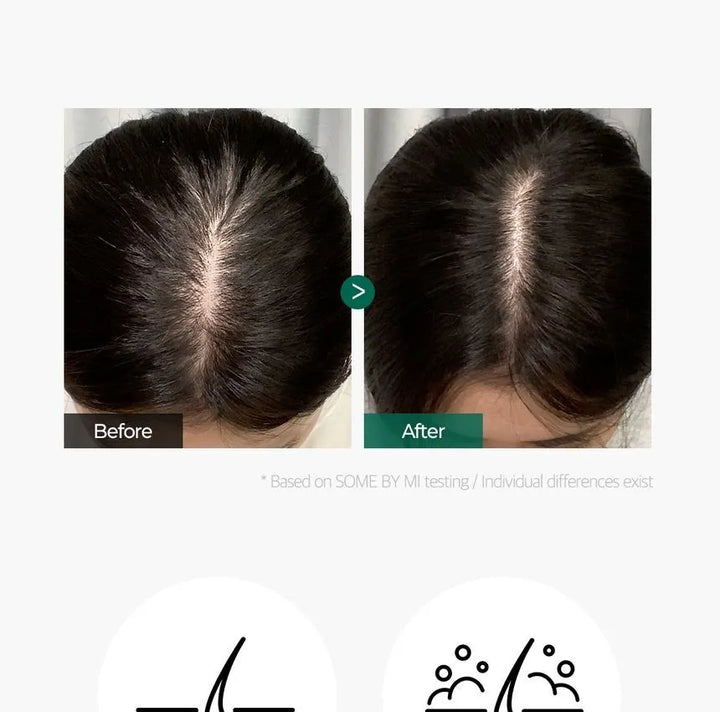 Some By Mi - Miracle Hair & Body Starter Kit 4 Piece Kit - Mhalaty